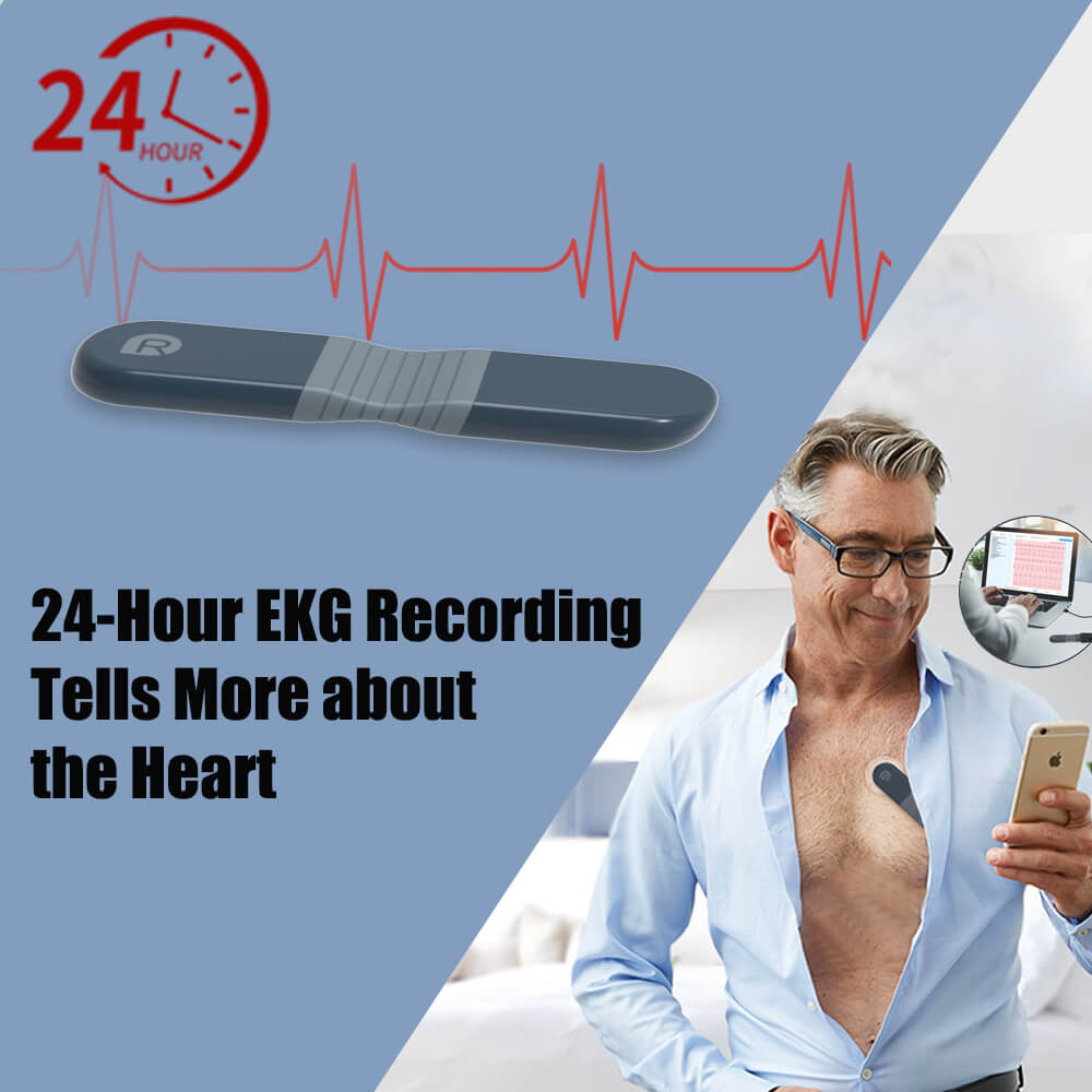 24-hour ECG Holter Monitoring Service - ECG on Demand