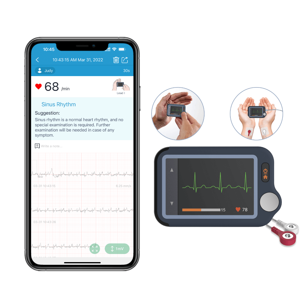 Checkme™ Pro Vital Signs Monitor - All-in-one machine integrating ECG  monitor, oximeter, blood pressure monitor, thermometer, sleep monitor and  mini monitor. – MDcubes